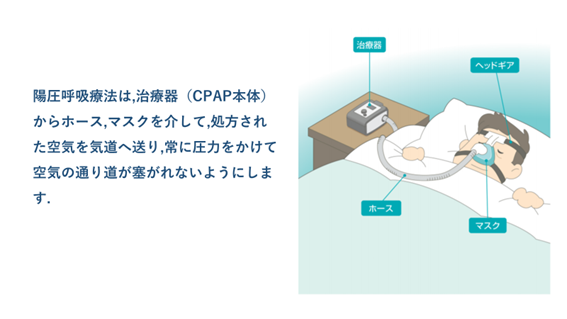 陽圧呼吸療法（cpap）｜日本医科大学千葉北総病院